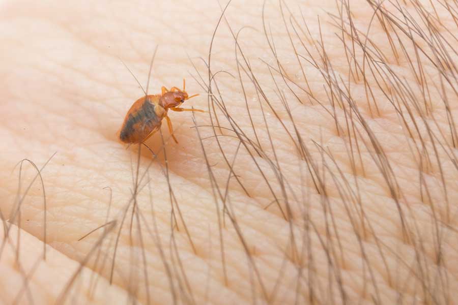 Close up of a bed bug on a person's arm - Allied Pest Control in Memphis TN